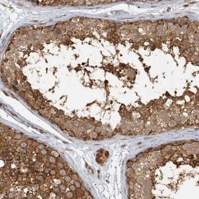Immunohistochemistry-Paraffin: AKD1 Antibody [NBP2-33936]