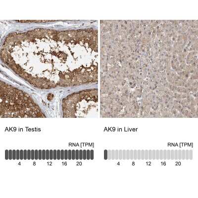 Immunohistochemistry-Paraffin: AKD1 Antibody [NBP2-33936]