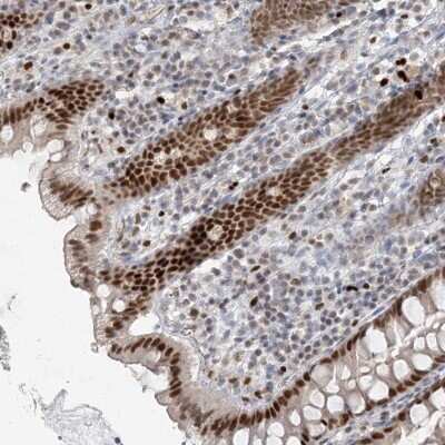 Immunohistochemistry-Paraffin: AKD1 Antibody [NBP2-33937]