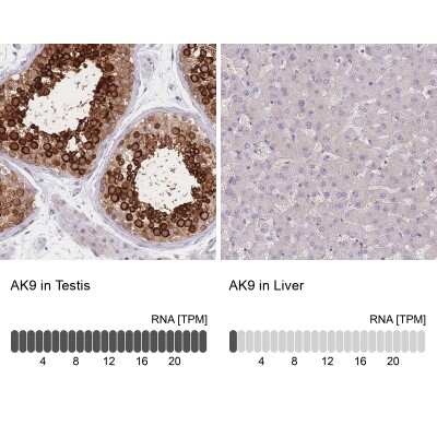 Immunohistochemistry-Paraffin: AKD1 Antibody [NBP2-34033]