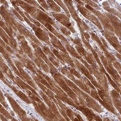 Immunohistochemistry-Paraffin: AKIRIN1 Antibody [NBP2-14749]