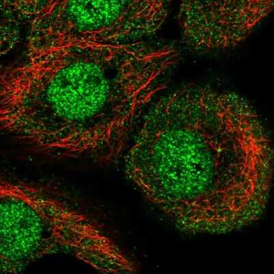 Immunocytochemistry/ Immunofluorescence: AKNA Antibody [NBP2-56577]