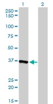 Western Blot: AKR1A1 Antibody (1A11-2A4) [H00010327-M01]