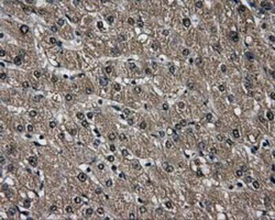 Immunohistochemistry-Paraffin: AKR1A1 Antibody (OTI6E3) [NBP2-02164]
