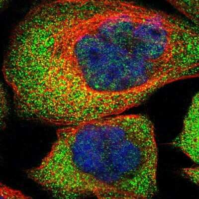 Immunocytochemistry/ Immunofluorescence: AKR1A1 Antibody [NBP1-89121]