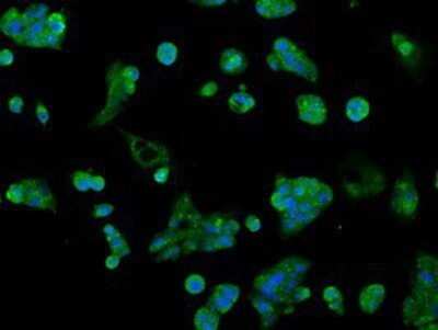 Immunocytochemistry/ Immunofluorescence: AKR1A1 Antibody (OTI6E3) - Azide and BSA Free [NBP2-71591]