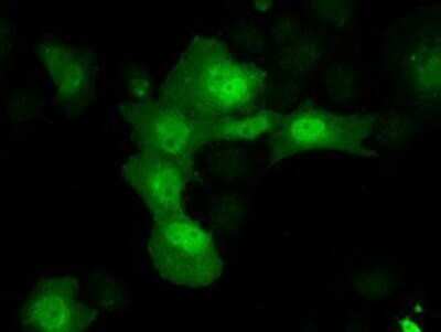 Immunocytochemistry/ Immunofluorescence: AKR1A1 Antibody (OTI6E3) - Azide and BSA Free [NBP2-71591]