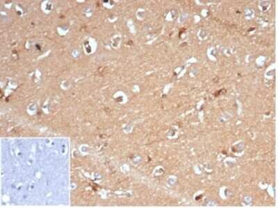 Immunohistochemistry-Paraffin: AKR1B1 Antibody (AKR1B1/7009R) [NBP3-13896]