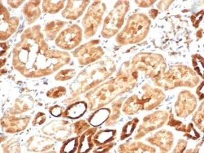 Immunohistochemistry-Paraffin: AKR1B1 Antibody (AKR1B1/7010R) [NBP3-13897]