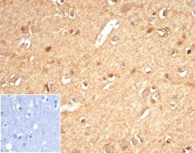 Immunohistochemistry-Paraffin: AKR1B1 Antibody (AKR1B1/7010R) [NBP3-13897]