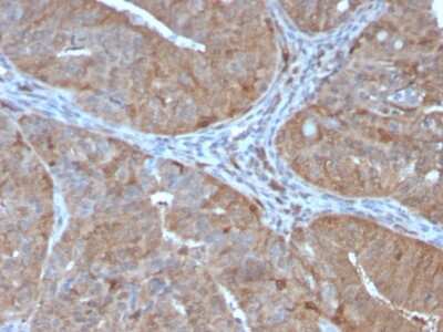 Immunohistochemistry-Paraffin: AKR1B1 Antibody (CPTC-AKR1B1-2) [NBP2-79797]