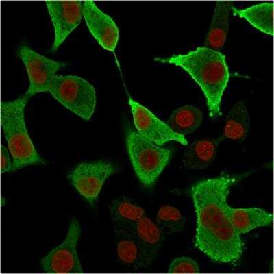 Immunocytochemistry/ Immunofluorescence: AKR1B1 Antibody (CPTC-AKR1B1-3) - Azide and BSA Free [NBP2-79930]