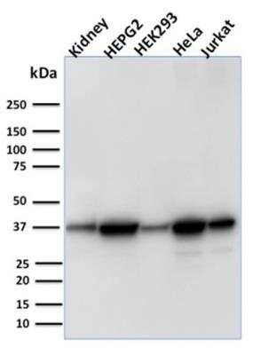 Western Blot: AKR1B1 Antibody (CPTC-AKR1B1-3)Azide and BSA Free [NBP2-79930]