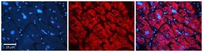 Immunohistochemistry: AKR1B1 Antibody [NBP1-53144]