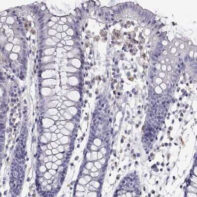 Immunohistochemistry: AKR1B1 Antibody [NBP1-89146]
