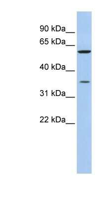Western Blot: AKR1B1 Antibody [NBP1-53144]