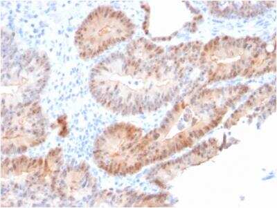 Immunohistochemistry-Paraffin: AKR1C2 Antibody (CPTC-AKR1C2-1) - Azide and BSA Free [NBP2-79909]