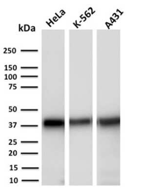Western Blot: AKR1C2 Antibody (CPTC-AKR1C2-1) [NBP2-79775]
