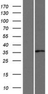 Western Blot: AKR1CL2 Overexpression Lysate [NBP2-10632]