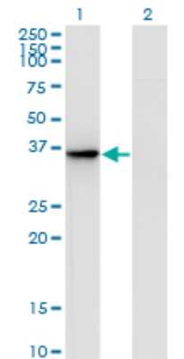 Western Blot: AKR1D1 Antibody (1A6) [H00006718-M01]