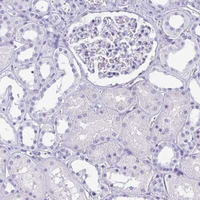 Immunohistochemistry-Paraffin: AKR1D1 Antibody [NBP2-33811]