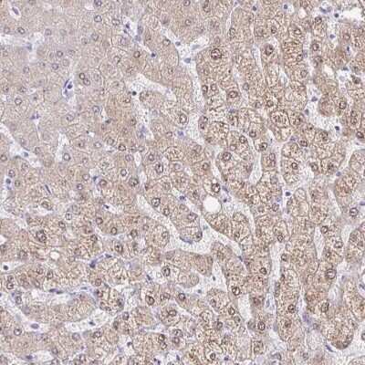 Immunohistochemistry-Paraffin: AKR1D1 Antibody [NBP2-33811]