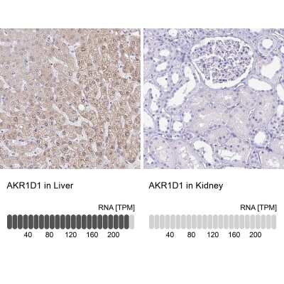 Immunohistochemistry-Paraffin: AKR1D1 Antibody [NBP2-33811]