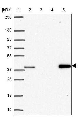 Western Blot: AKR1D1 Antibody [NBP2-33811]