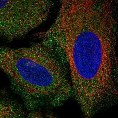 Immunocytochemistry/ Immunofluorescence: AKR7A2 Antibody [NBP2-56509]