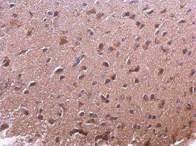 Immunohistochemistry-Paraffin: AKR7A2 Antibody [NBP1-32828]