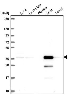 Western Blot: AKR7A2 Antibody [NBP2-56509]