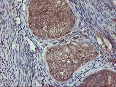 Immunohistochemistry-Paraffin: AKT1 Antibody (OTI4D6) [NBP2-01724]