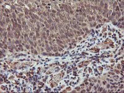 Immunohistochemistry-Paraffin: AKT1 Antibody (OTI4D6) [NBP2-01724]