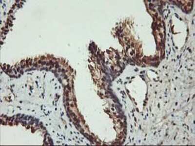 Immunohistochemistry-Paraffin: AKT1 Antibody (OTI4D6) [NBP2-01724]