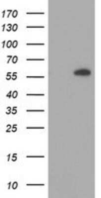 Western Blot: AKT1 Antibody (OTI4D6) [NBP2-01724]