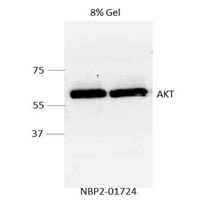 Western Blot: AKT1 Antibody (OTI4D6) [NBP2-01724]