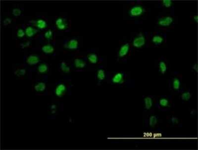 Immunocytochemistry/ Immunofluorescence: AKT2 Antibody (1D9) [H00000208-M03]