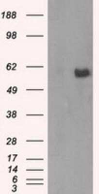 Western Blot: AKT2 Antibody (OTI4H7) [NBP2-02231]