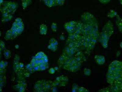 Immunocytochemistry/ Immunofluorescence: AKT2 Antibody (OTI4H7) - Azide and BSA Free [NBP2-70146]