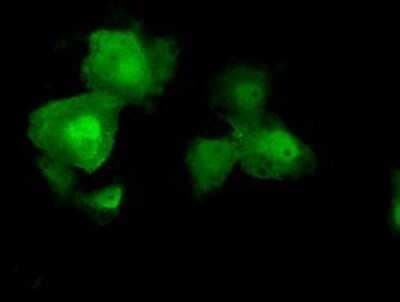Immunocytochemistry/ Immunofluorescence: AKT2 Antibody (OTI4H7) - Azide and BSA Free [NBP2-70146]
