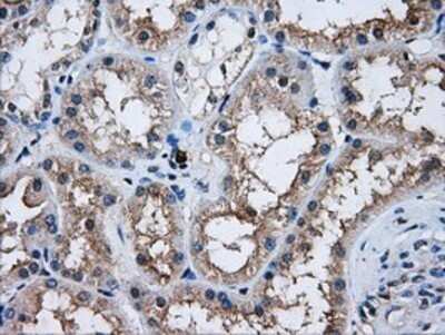 Immunohistochemistry: AKT2 Antibody (OTI4H7) - Azide and BSA Free [NBP2-70146]