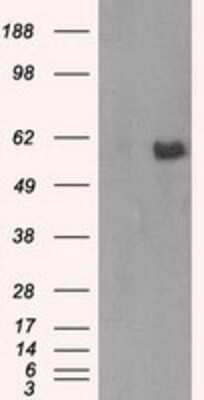 Western Blot: AKT2 Antibody (OTI4H7)Azide and BSA Free [NBP2-70146]