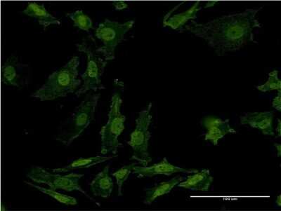Immunocytochemistry/ Immunofluorescence: AKT2 Antibody (X1) [H00000208-M06]