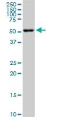 Western Blot: AKT2 Antibody (X1) [H00000208-M06]