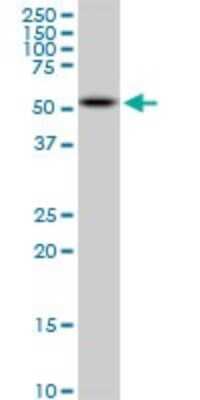 Western Blot: AKT2 Antibody (X1) [H00000208-M06]