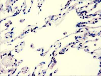 Immunohistochemistry-Paraffin: AKT3 Antibody (OTI9B2) [NBP1-47657]