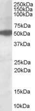 Western Blot: AKT3 Antibody [NB100-1480]