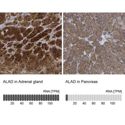 Immunohistochemistry-Paraffin: ALAD Antibody [NBP1-89158]