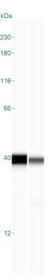Simple Western: ALAD Antibody [NBP1-89158]