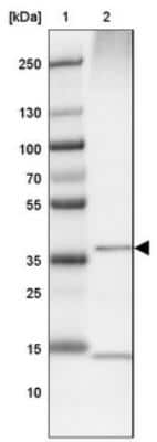 Western Blot: ALAD Antibody [NBP1-89158]